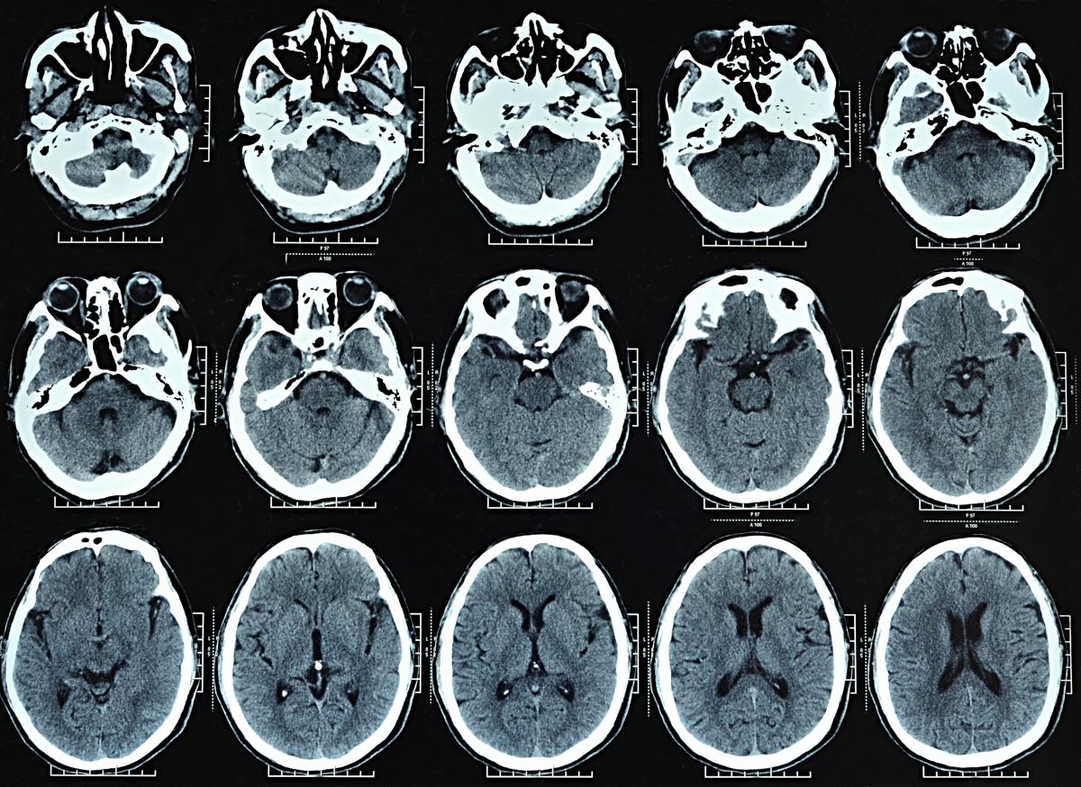 ct-imaging-angels-initiative